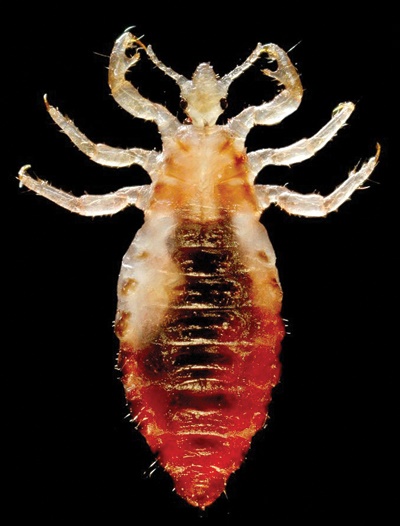 Body Lice 1